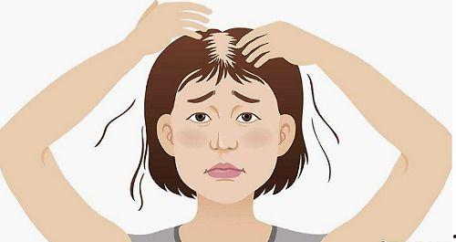 明星怎么处理脱发,明星们的护发之道